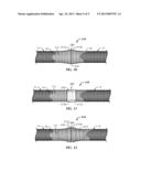 Glass Fiber Closure Gasket Terminations diagram and image