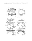 Relieved Bearing Adapter for Railroad Freight Car Truck diagram and image