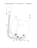 NARES MASK AND SUPPORT APPARATUS diagram and image