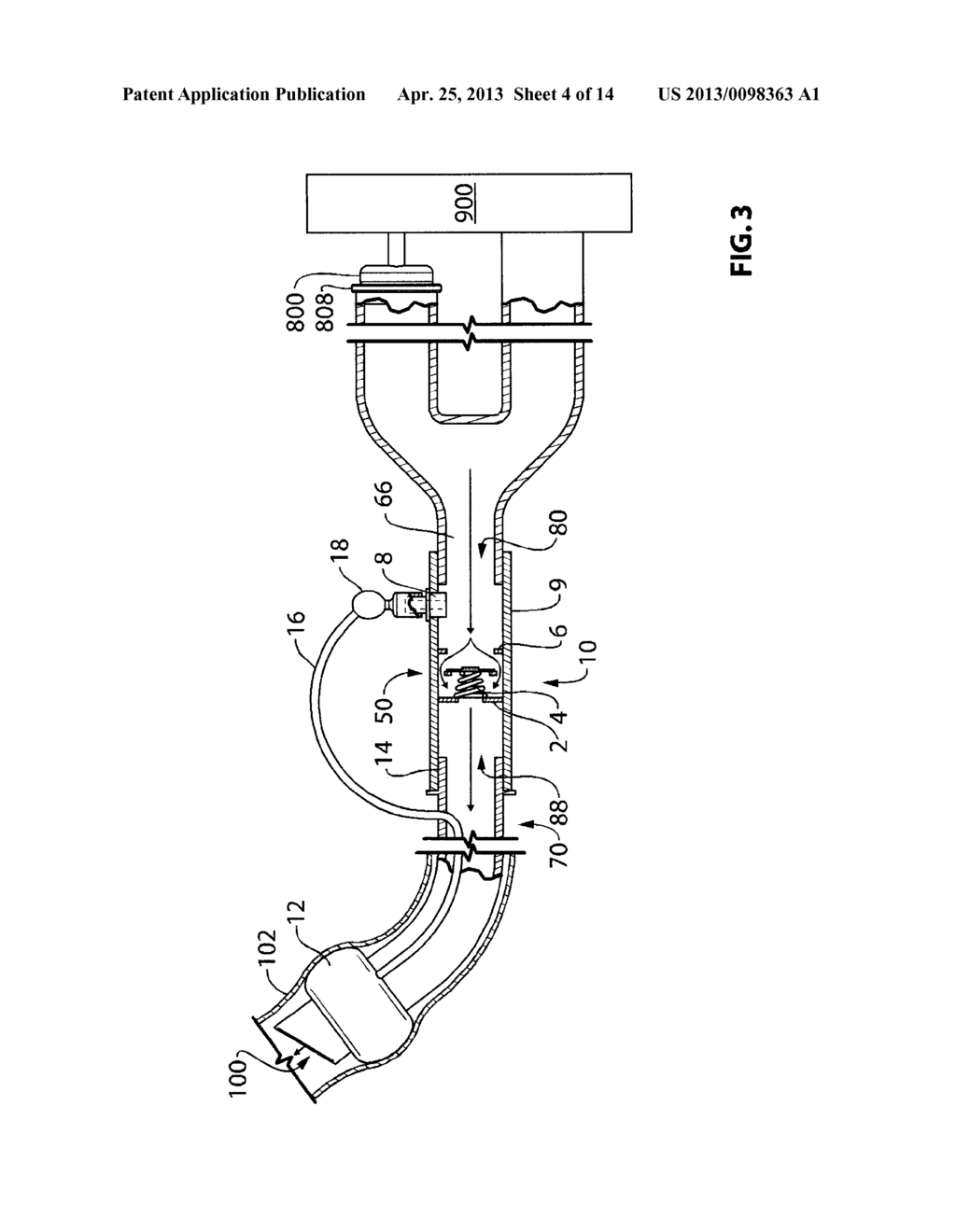 ENDOTRACHEAL CUFF PRESSURE REGULATION CIRCUIT AND METHOD - diagram, schematic, and image 05