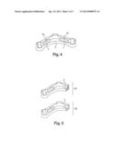 PROCESS FOR MANUFACTURING FORGINGS MADE OF LIGHT ALLOY, INCORPORATING     SOLID OR THINNED-DOWN SECTIONS diagram and image