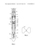 MONOBORE EXPANSION SYSTEM - ANCHORED LINER diagram and image