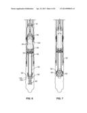 MONOBORE EXPANSION SYSTEM - ANCHORED LINER diagram and image