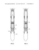 MONOBORE EXPANSION SYSTEM - ANCHORED LINER diagram and image