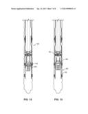 MONOBORE EXPANSION SYSTEM - ANCHORED LINER diagram and image