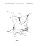 BAG RIGIDIZER diagram and image