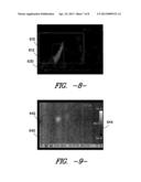 TIRE SURFACE ANOMALY DETECTION diagram and image