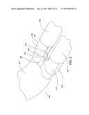 MULTIPLE-LEG DISCHARGE BOOT FOR SLURRY DISTRIBUTION diagram and image