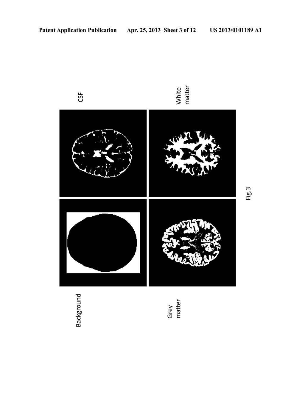 System and Method for Medical Image Intensity Standardization - diagram, schematic, and image 04