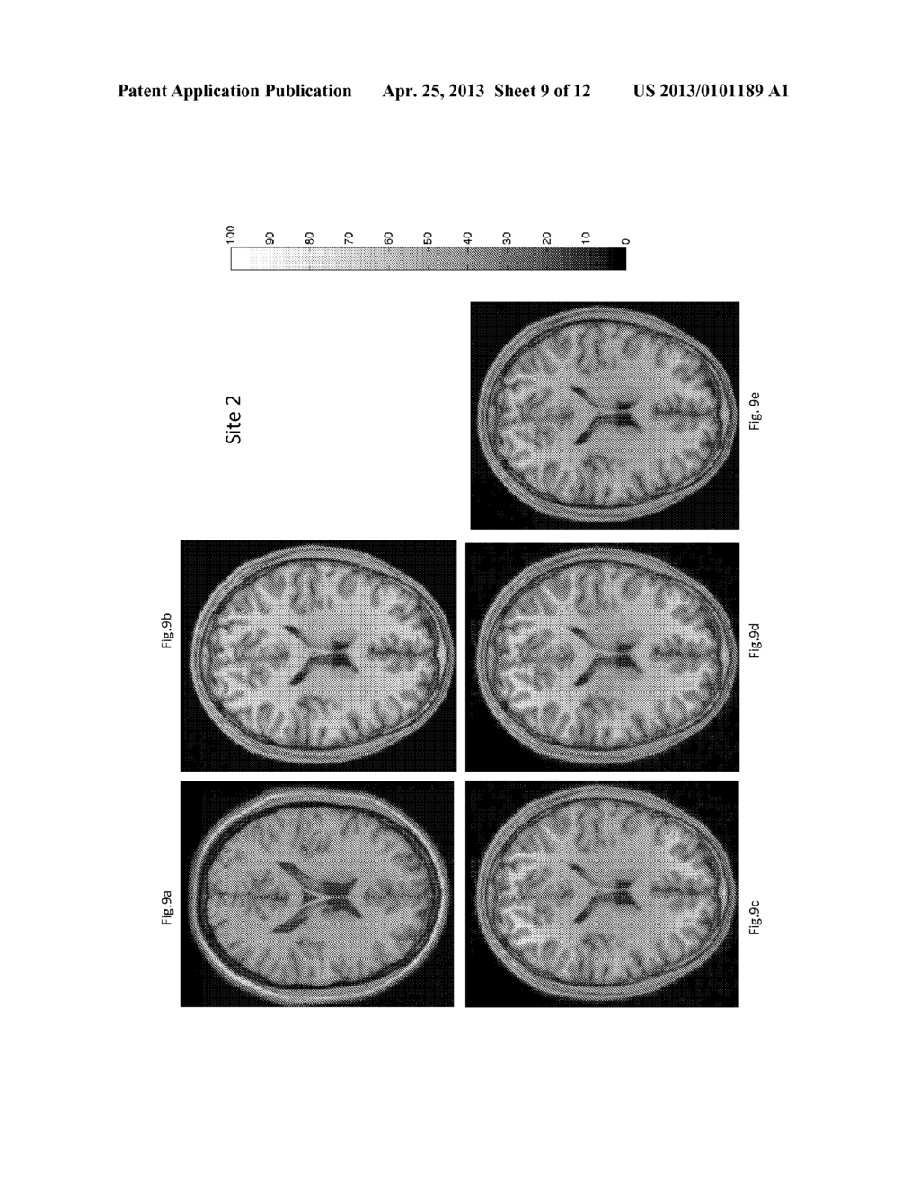 System and Method for Medical Image Intensity Standardization - diagram, schematic, and image 10