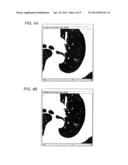 METHOD AND SYSTEM FOR SUPPLEMENTING DETAIL IMAGE IN SUCCESSIVE MULTI-SCALE     RECONSTRUCTION diagram and image