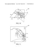 NAVIGATING AN INTERVENTIONAL DEVICE diagram and image