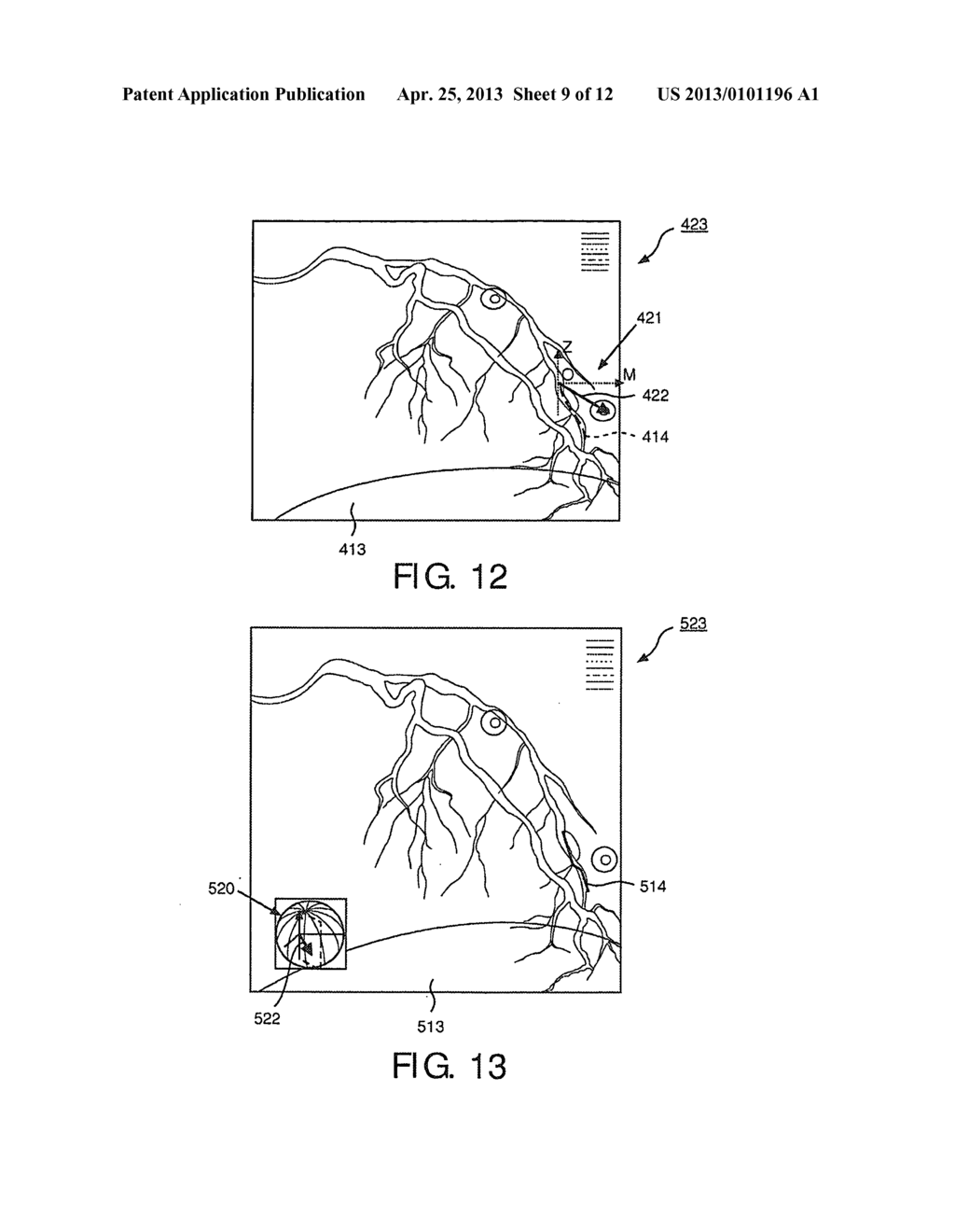 NAVIGATING AN INTERVENTIONAL DEVICE - diagram, schematic, and image 10