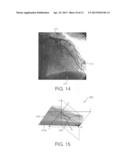 NAVIGATING AN INTERVENTIONAL DEVICE diagram and image