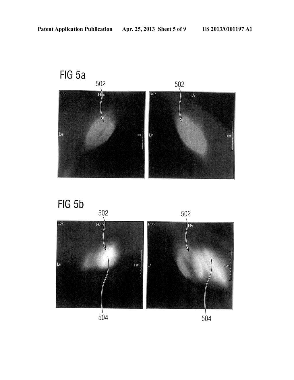 METHOD AND APPARATUS FOR GENERATING AN ENHANCED IMAGE FROM MEDICAL IMAGING     DATA - diagram, schematic, and image 06