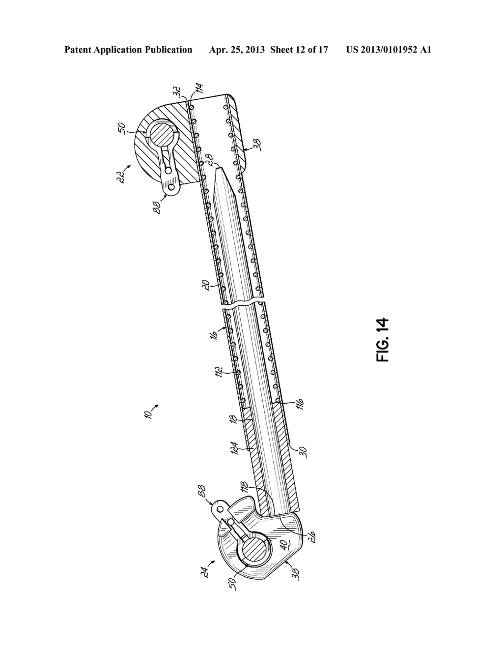 ORTHODONTIC DEVICE AND METHOD FOR TREATING MALOCCLUSIONS - diagram, schematic, and image 13