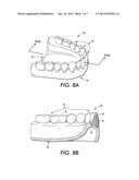 DENTURE AND METHOD AND APPARATUS OF MAKING SAME diagram and image