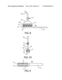 TOOTHBRUSH WITH REACTIVE COMPOSITION FOR REMINERALIZATION OF TEETH diagram and image