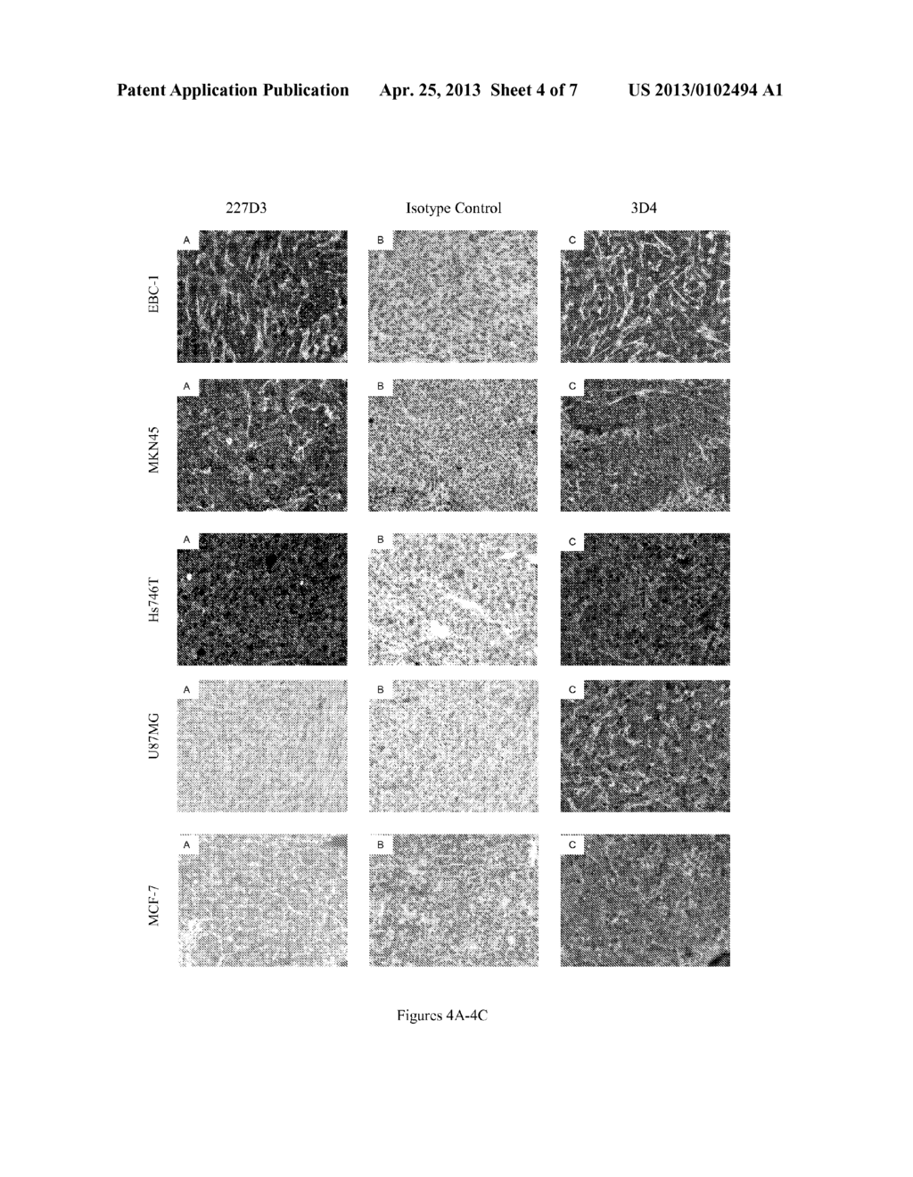 NOVEL ANTIBODY FOR THE DIAGNOSIS AND/OR PROGNOSIS OF CANCER - diagram, schematic, and image 05