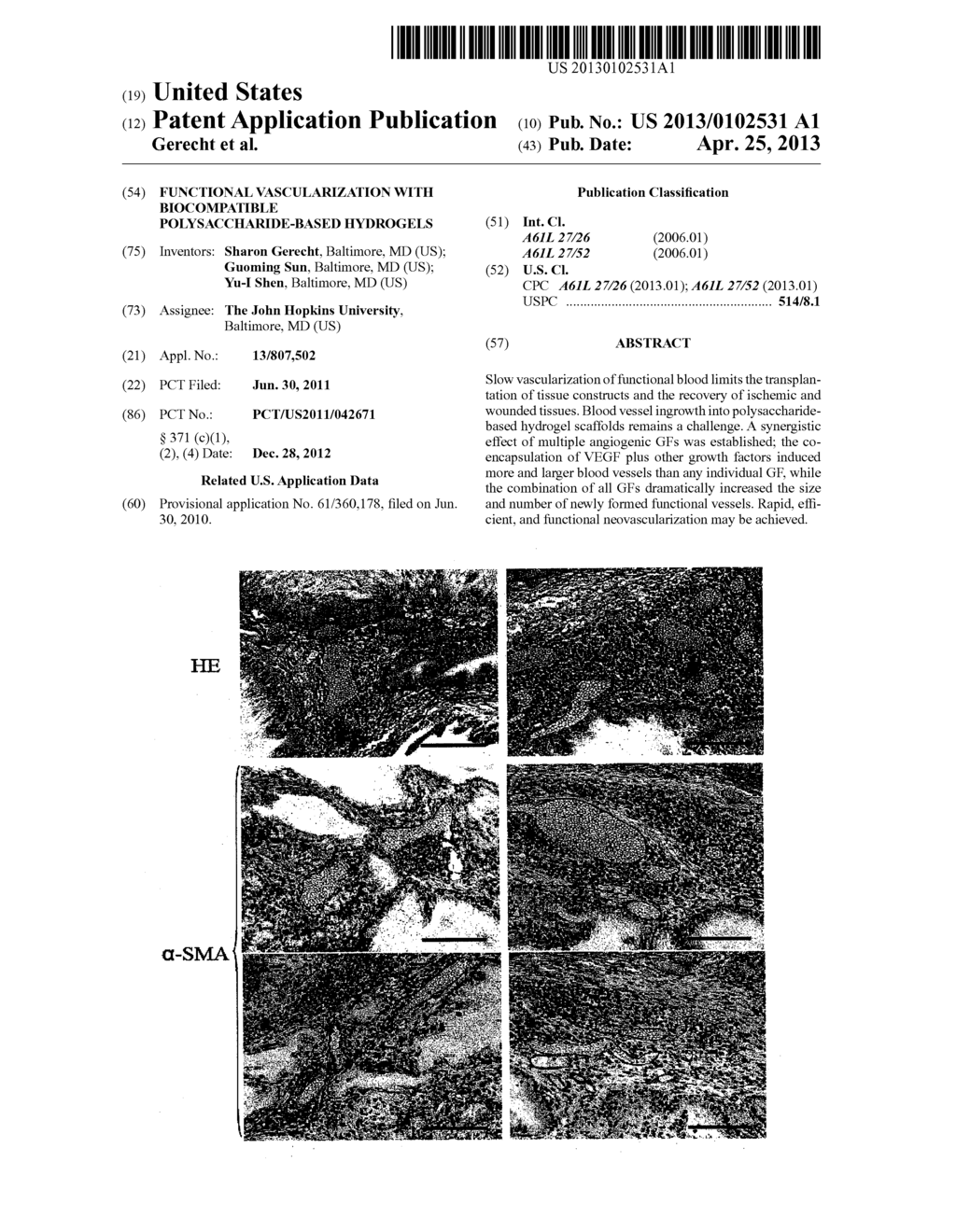 FUNCTIONAL VASCULARIZATION WITH BIOCOMPATIBLE POLYSACCHARIDE-BASED     HYDROGELS - diagram, schematic, and image 01