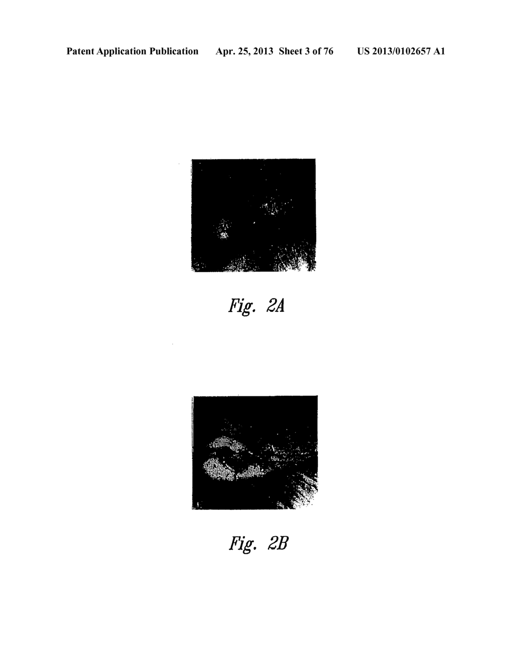 ANTI-ANGIOGENIC COMPOSITIONS AND METHODS OF USE - diagram, schematic, and image 04