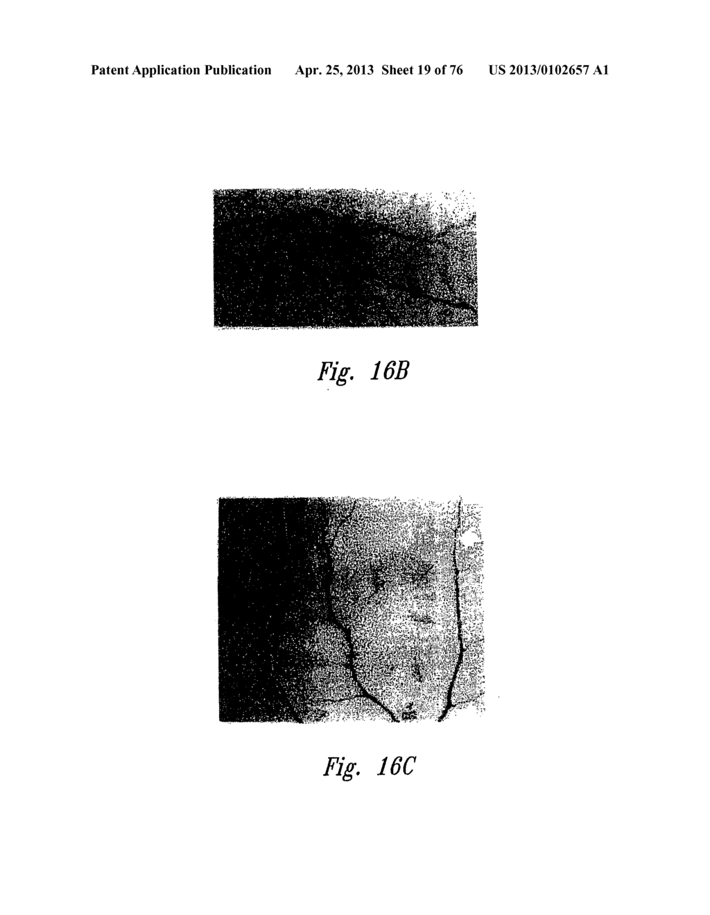 ANTI-ANGIOGENIC COMPOSITIONS AND METHODS OF USE - diagram, schematic, and image 20