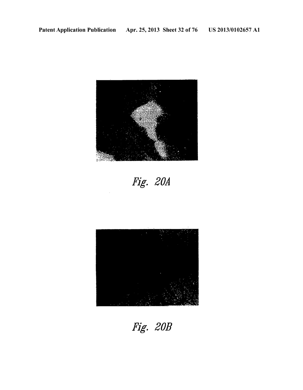 ANTI-ANGIOGENIC COMPOSITIONS AND METHODS OF USE - diagram, schematic, and image 33