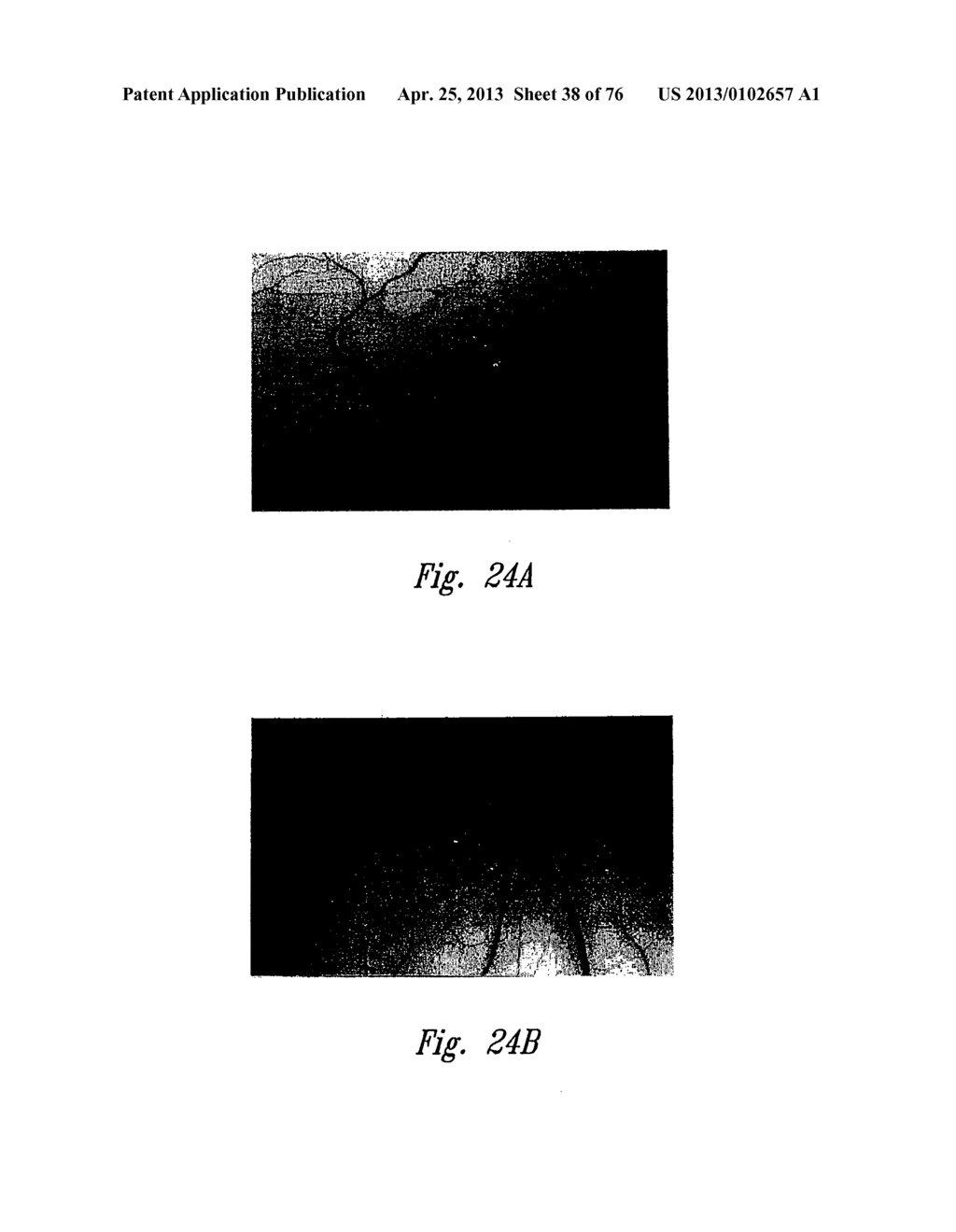 ANTI-ANGIOGENIC COMPOSITIONS AND METHODS OF USE - diagram, schematic, and image 39