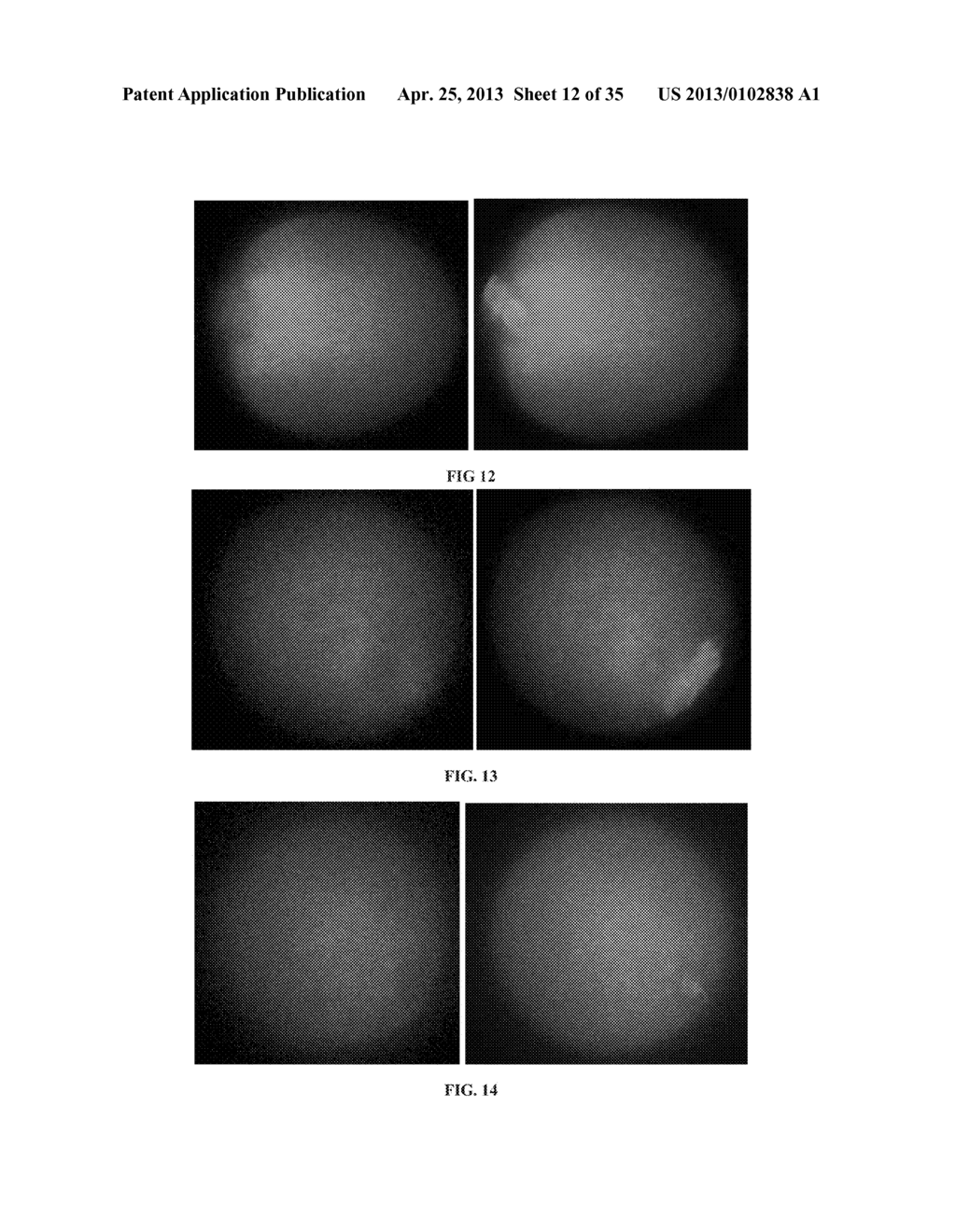 Oocyte Spindle-Associated Factors Improve Somatic Cell Cloning - diagram, schematic, and image 13