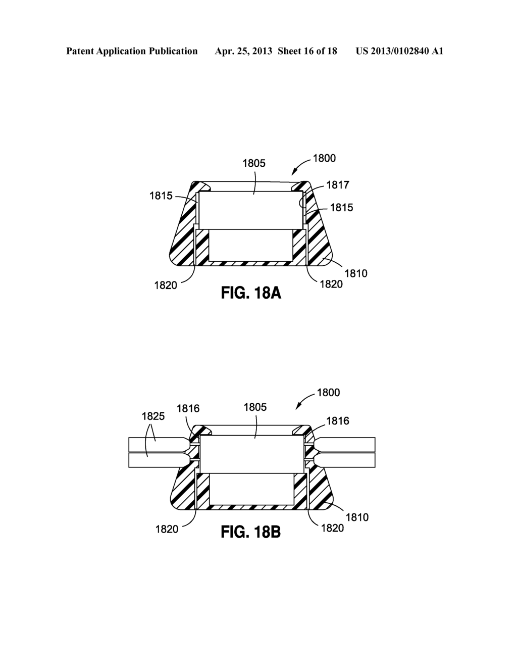 IMPLANTABLE INJECTION PORT - diagram, schematic, and image 17