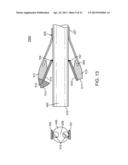 JAWED TROCAR ASSEMBLY diagram and image