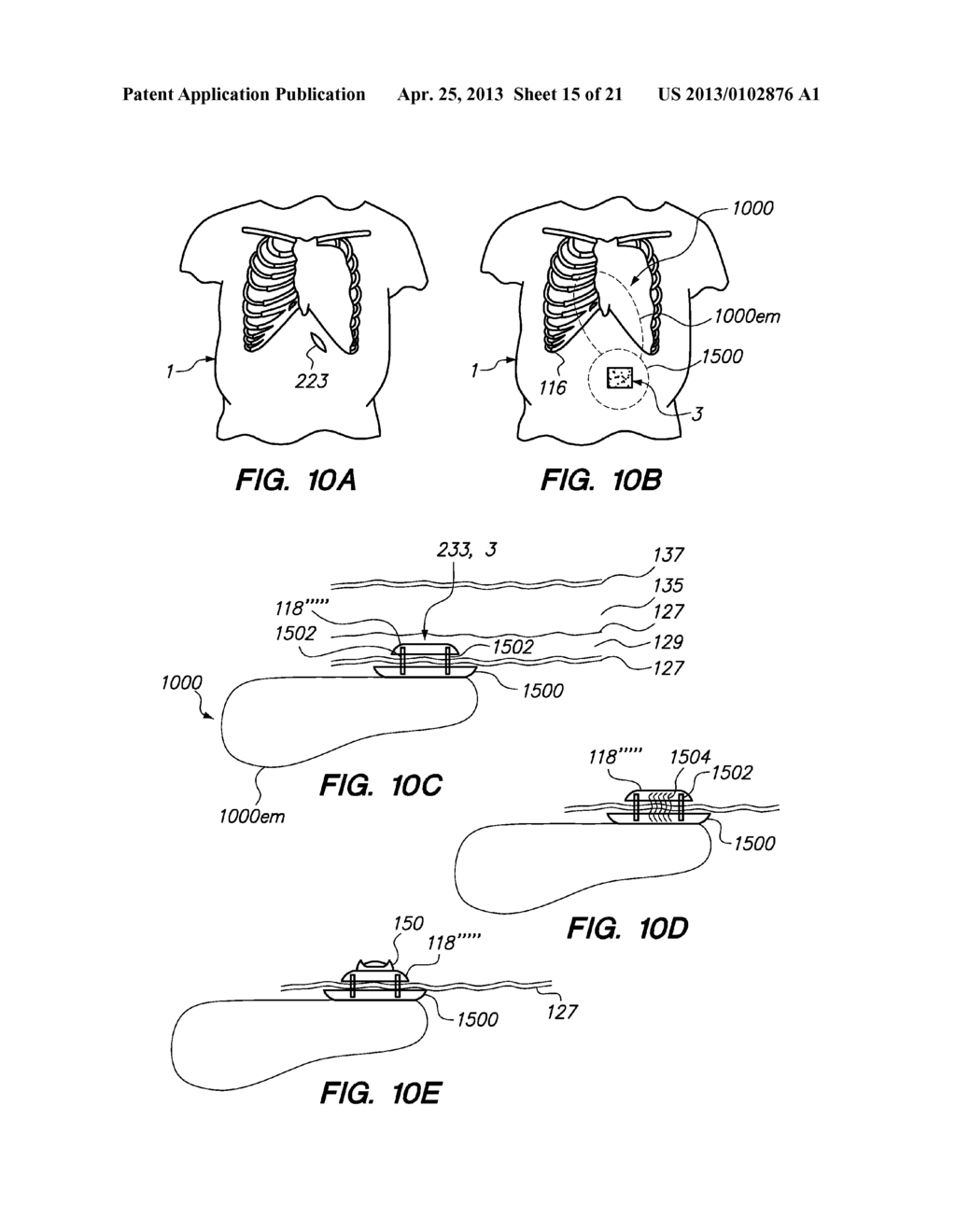 Port System and Methods - diagram, schematic, and image 16