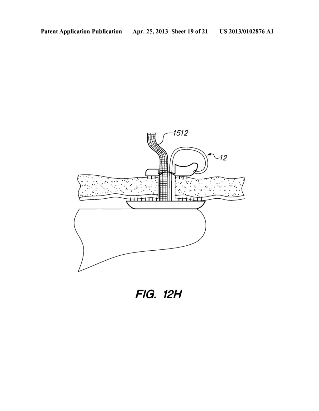 Port System and Methods - diagram, schematic, and image 20