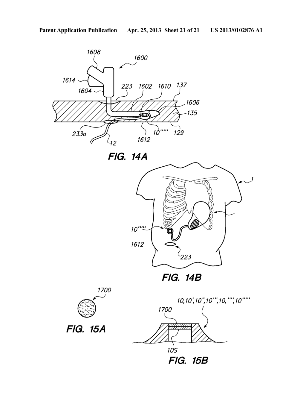 Port System and Methods - diagram, schematic, and image 22