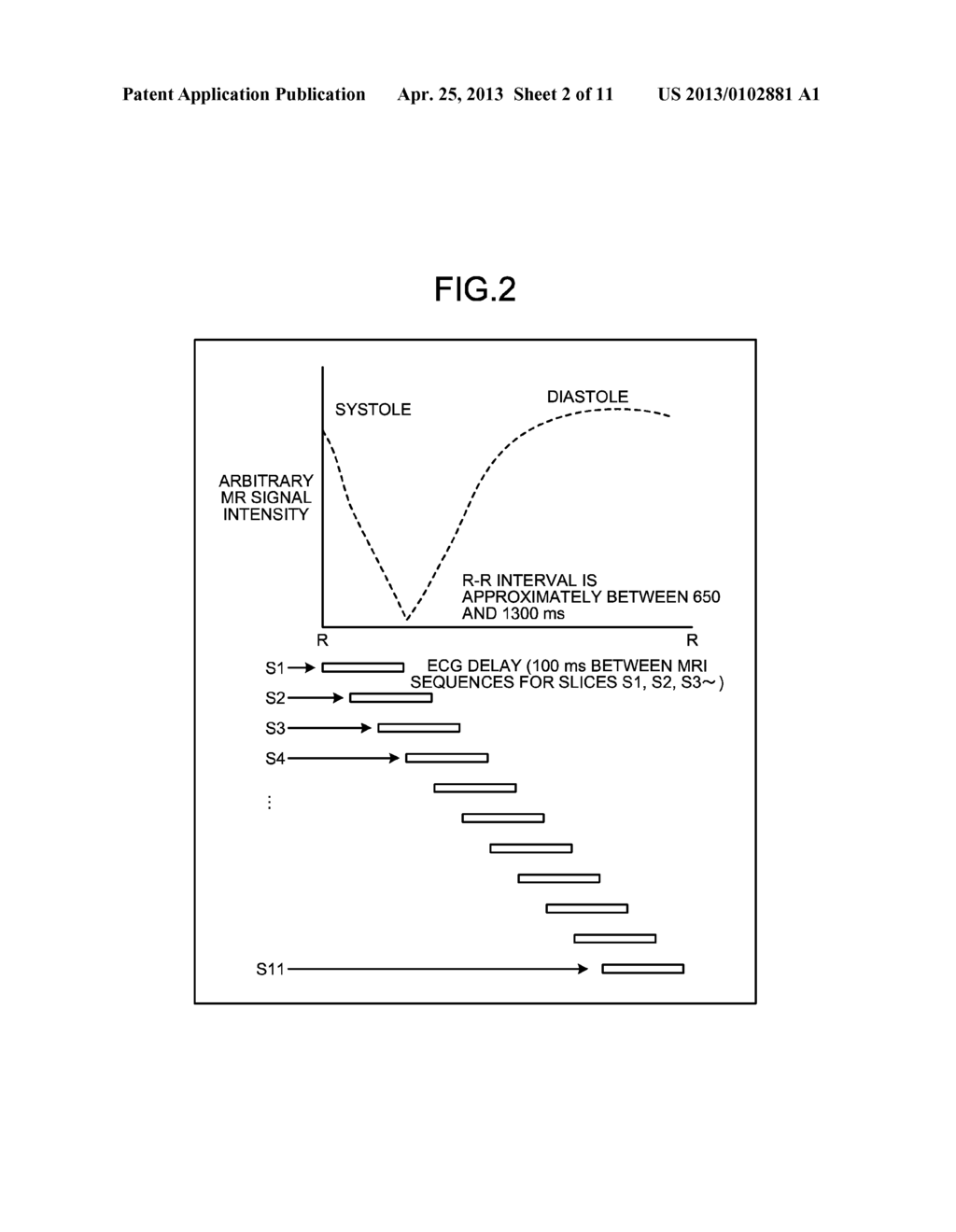 MAGNETIC RESONANCE IMAGING APPARATUS AND MAGNETIC RESONANCE IMAGING METHOD - diagram, schematic, and image 03