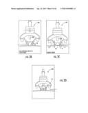 MRI-Guided Medical Interventional Systems and Methods diagram and image