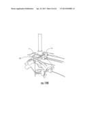 MRI-Guided Medical Interventional Systems and Methods diagram and image