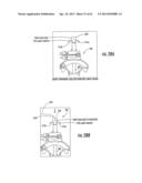 MRI-Guided Medical Interventional Systems and Methods diagram and image