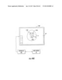 MRI-Guided Medical Interventional Systems and Methods diagram and image