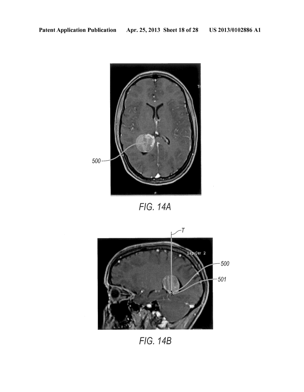 SURGICAL ACCESS SYSTEM WITH NAVIGATION ELEMENT AND METHOD OF USING SAME - diagram, schematic, and image 19