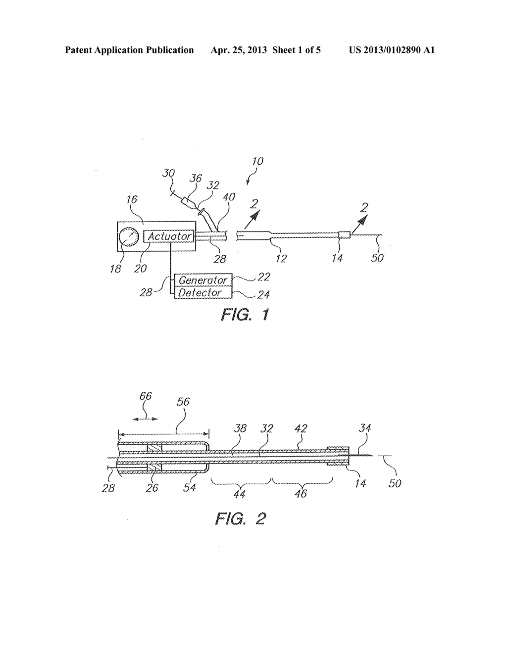 System and Method for Visualizing Catheter Placement in a Vasculature - diagram, schematic, and image 02