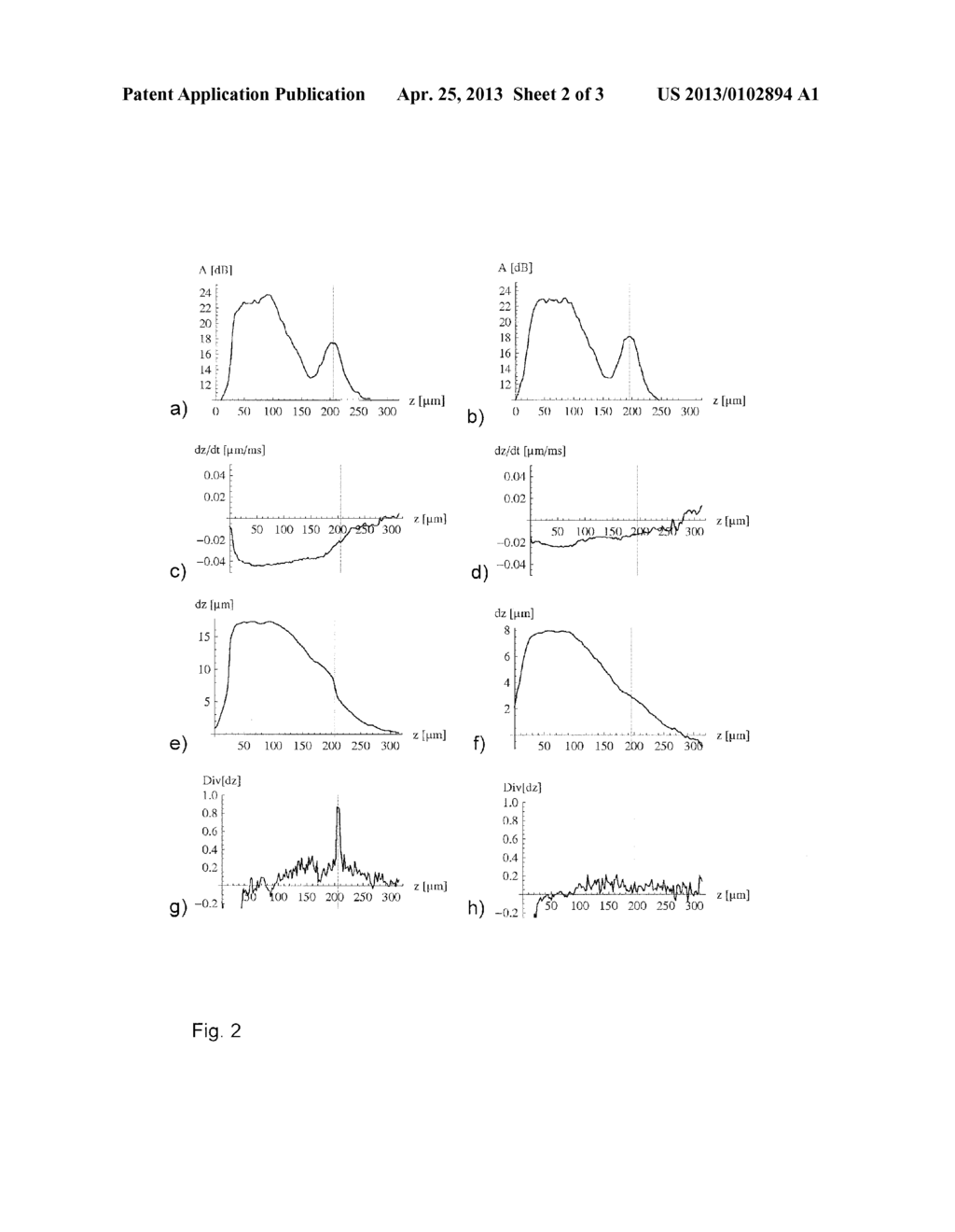 Device With an OCT System for Examining and Treating Living Tissue by     Means of Heating of the Tissue by Absorbing Electromagnetic Radiation - diagram, schematic, and image 03