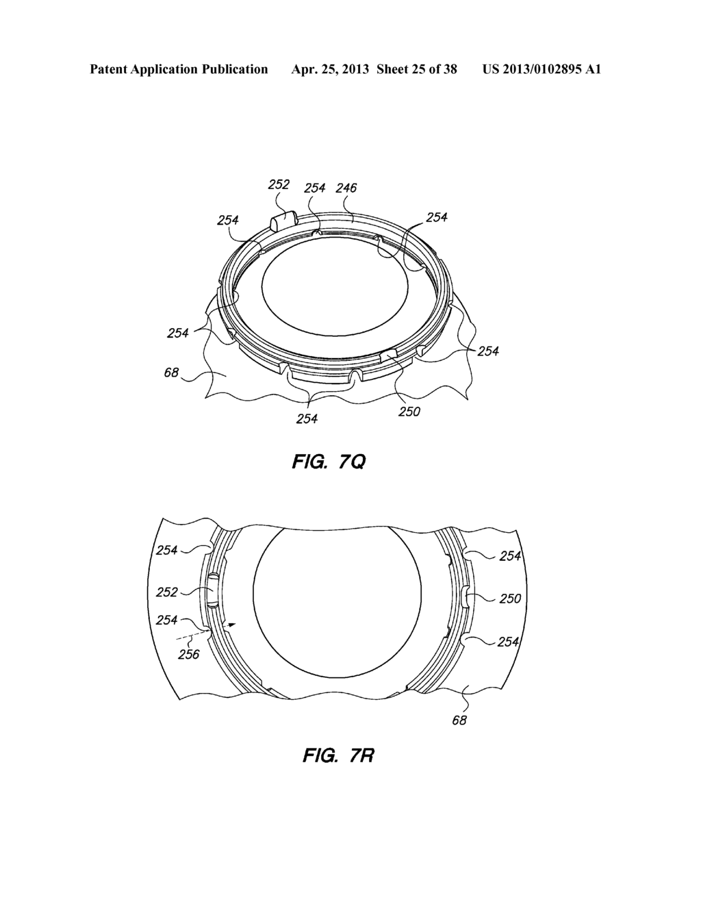 PATIENT INTERFACE FOR OPHTHALMOLOGIC DIAGNOSTIC AND INTERVENTIONAL     PROCEDURES - diagram, schematic, and image 26