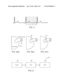 Radiation Treatment Planning and Delivery for Moving Targets in the Heart diagram and image