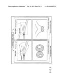 ULTRASONIC DIAGNOSTIC APPARATUS, MEDICAL IMAGE PROCESSING APPARTUS, AND     MEDICAL IMAGE PROCESSING METHOD diagram and image