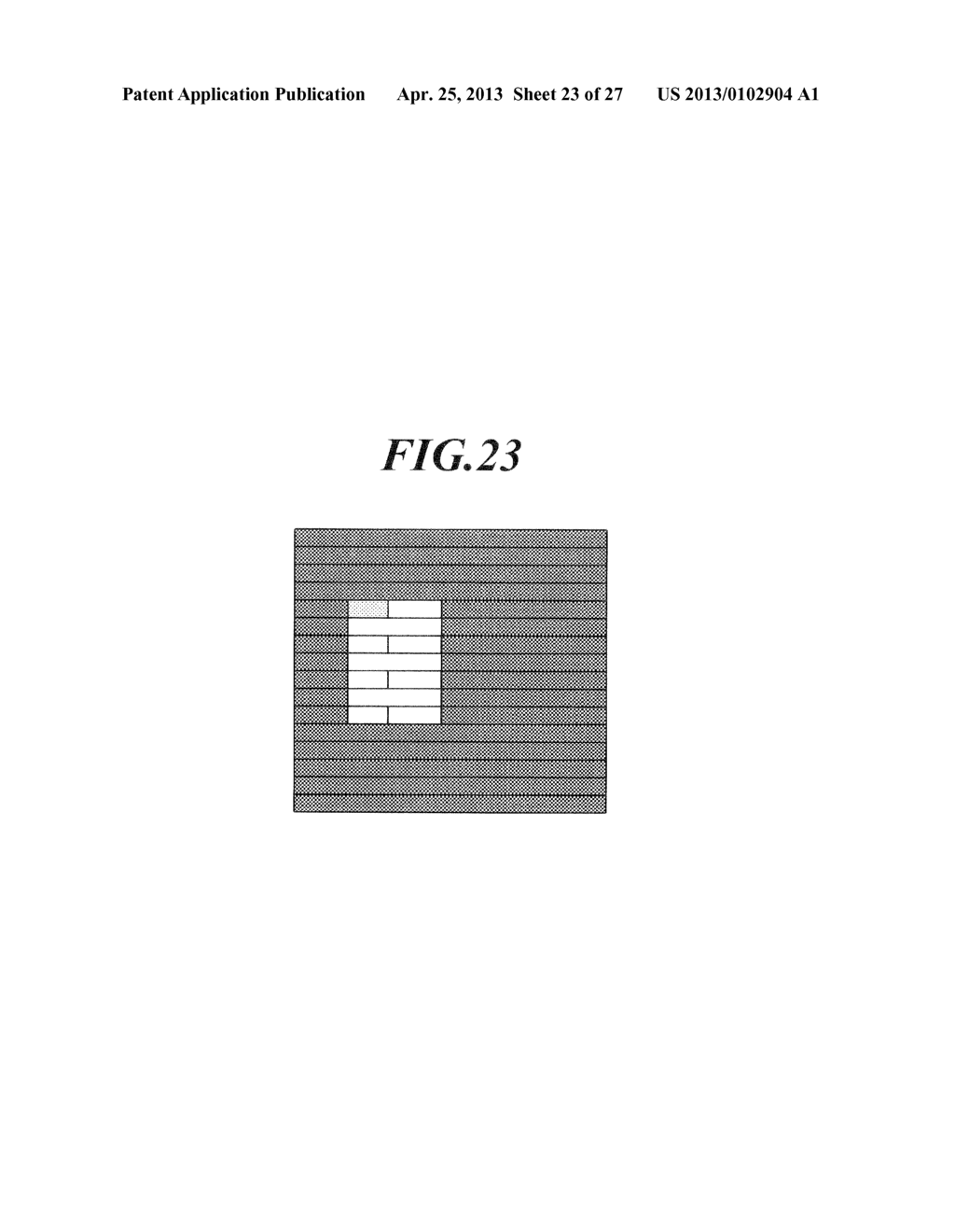 ULTRASONIC DIAGNOSTIC DEVICE AND PROGRAM - diagram, schematic, and image 24