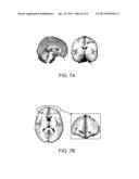 SYSTEM AND METHOD FOR DIAGNOSING AND TREATING PSYCHIATRIC DISORDERS diagram and image