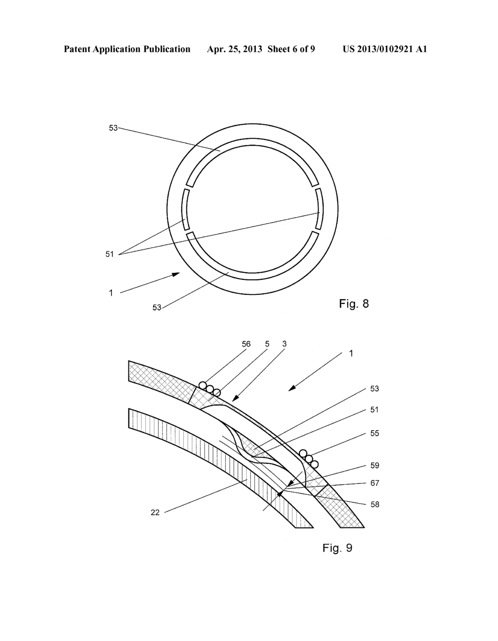 METHOD AND DEVICE FOR MONITORING BIOMECHANICAL PROPERTIES OF THE EYE - diagram, schematic, and image 07