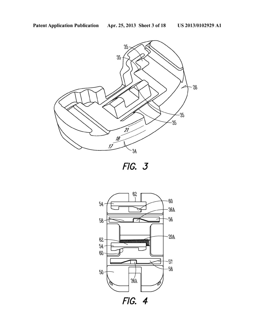 KNEE BALANCING DEVICES, SYSTEMS AND METHODS - diagram, schematic, and image 04