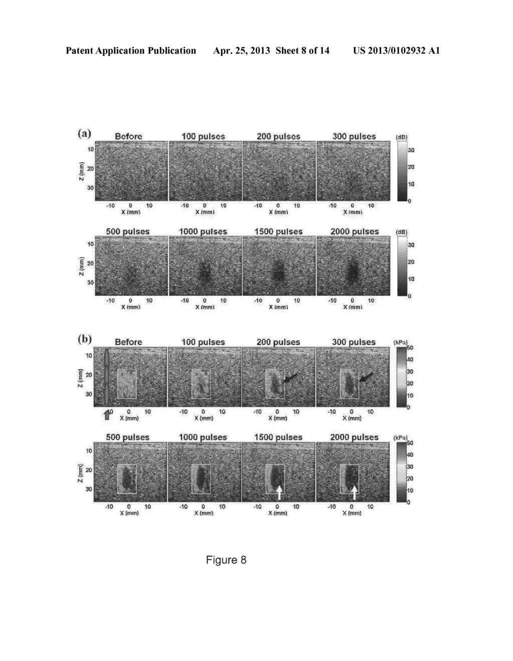 Imaging Feedback of Histotripsy Treatments with Ultrasound Transient     Elastography - diagram, schematic, and image 09